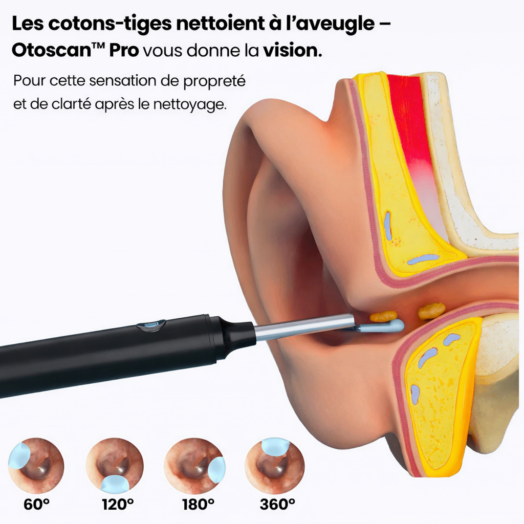 Otoscan™ Pro